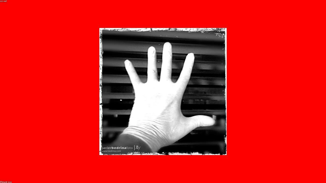 Nvidia's AI-Powered Healthcare Push: A Goldman-Backed Bull Case